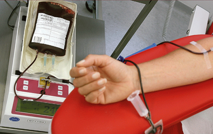 un braccio steso collegato ad una sacca di sangue tramite siringa