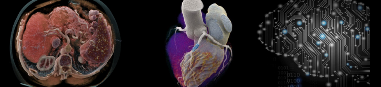 Sezioni del cuore e schema di un microchip a forma di cervello
